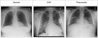 Improving disease classification performance and explainability of deep learning models in radiology with heatmap generators